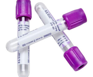 EDTA Tubes